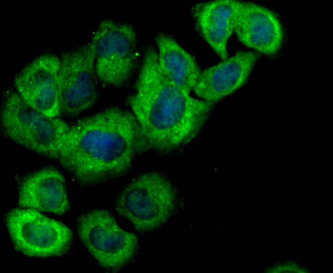Hemopexin Rabbit mAb