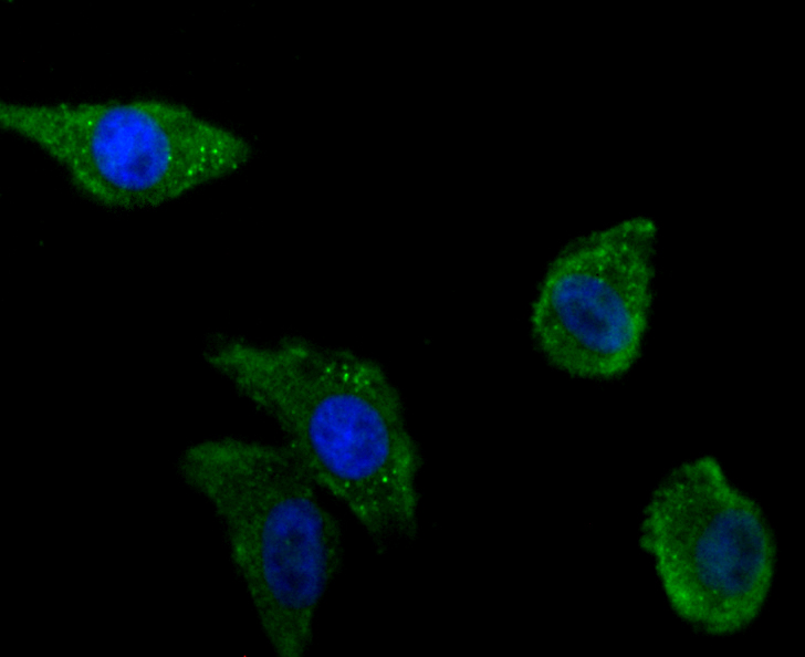 Zyxin Rabbit mAb