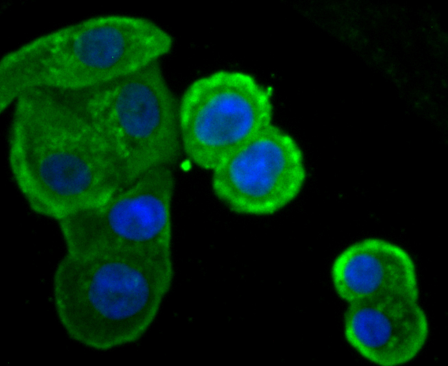 IKBKE Rabbit mAb