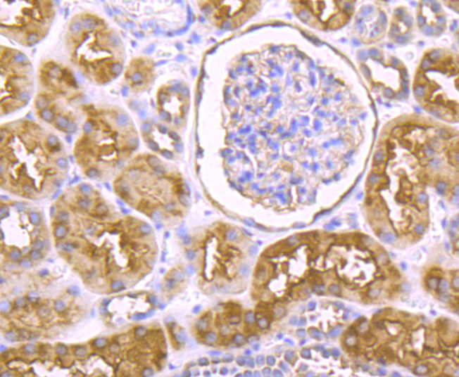 IKBKE Rabbit mAb