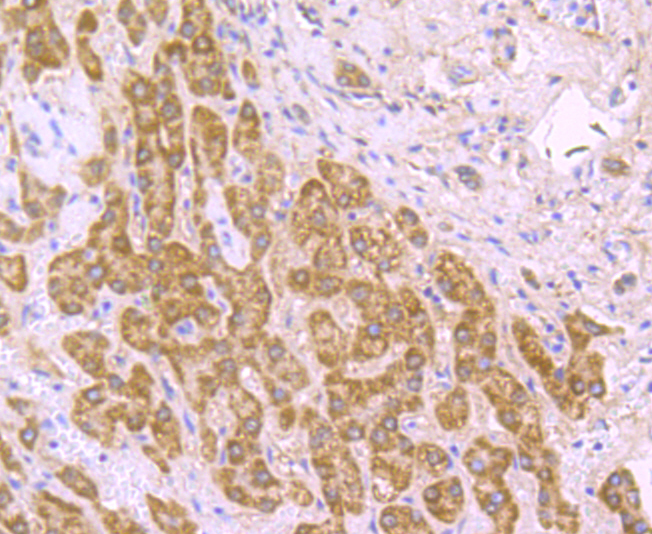 SDHB Rabbit mAb