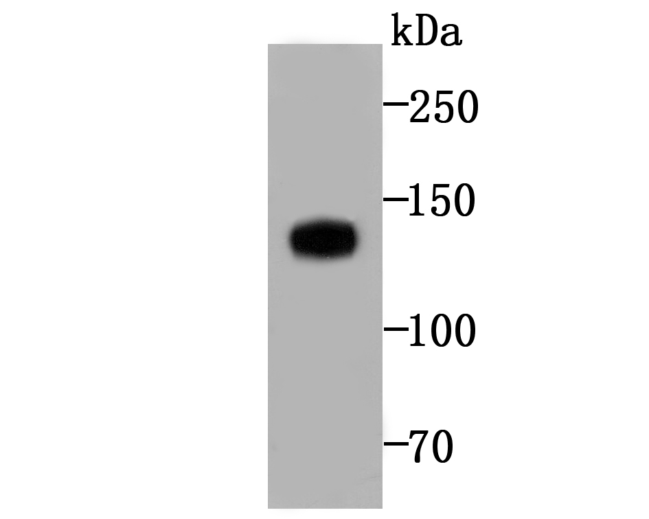 Involucrin Rabbit mAb