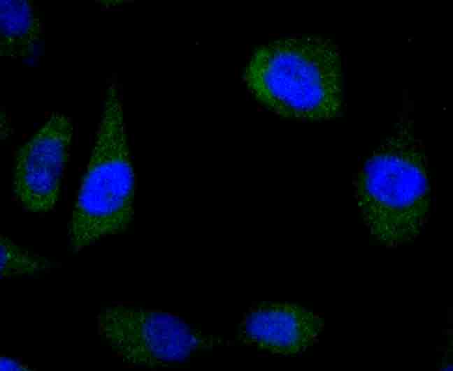 Wnt5a Rabbit mAb