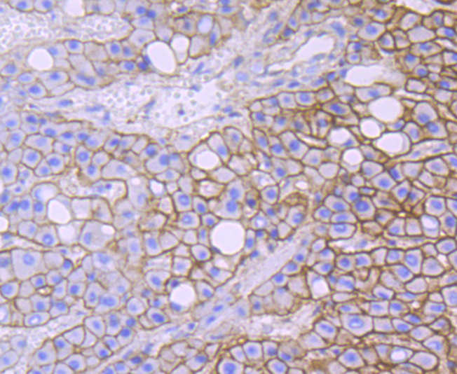Alpha Fodrin Rabbit mAb