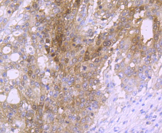 Carbonic anhydrase 2 Rabbit mAb