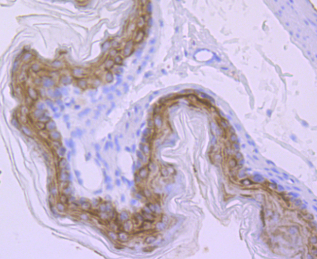 Carbonic anhydrase 2 Rabbit mAb