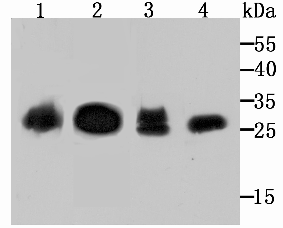 Carbonic anhydrase 2 Rabbit mAb