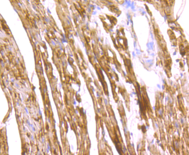 FABP3 Rabbit mAb