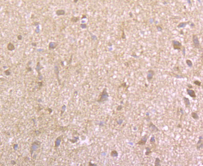 EAAT3 Rabbit mAb