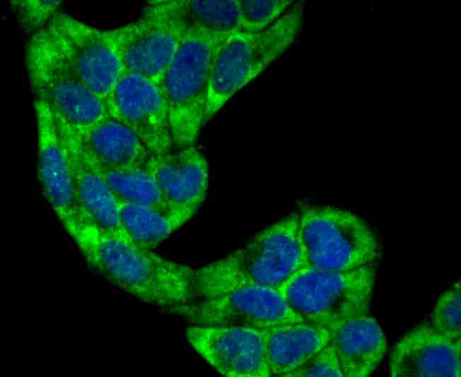 villin1 Rabbit mAb