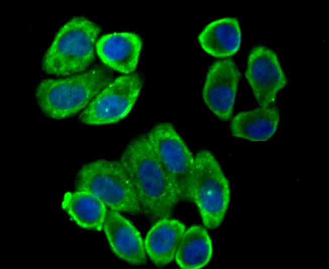 villin1 Rabbit mAb