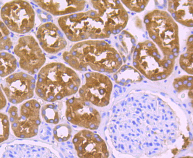 ALDH1L1 Rabbit mAb