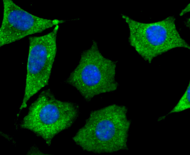 Septin 2 Rabbit mAb