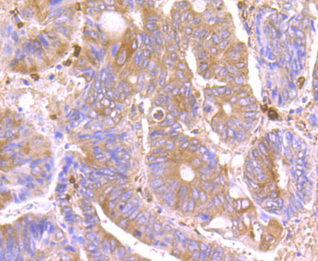 Septin 2 Rabbit mAb