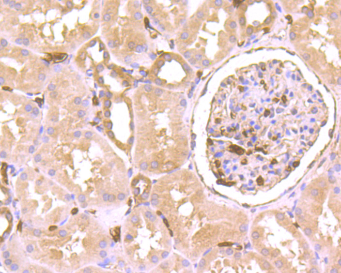 Septin 2 Rabbit mAb