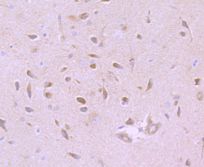 GABA A Receptor alpha 5 Rabbit mAb