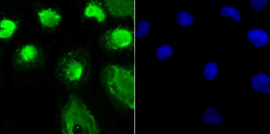 OGT Rabbit mAb
