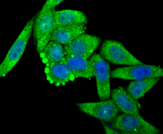 OGT Rabbit mAb