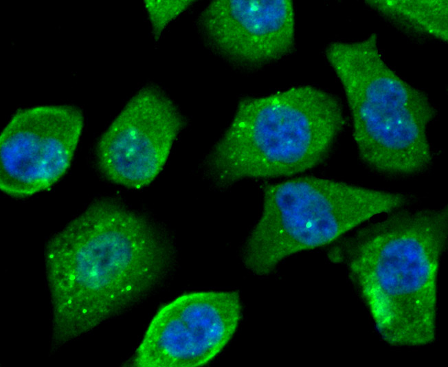 OGT Rabbit mAb