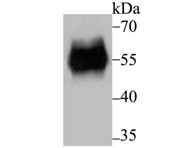 RBPJK Rabbit mAb