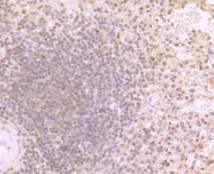 Proteasome 20S LMP2 Rabbit mAb