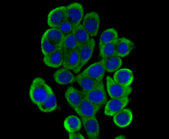 Dcp1a Rabbit mAb