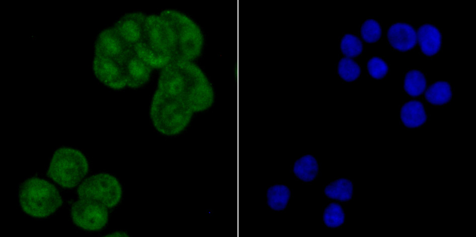 CRM1 Rabbit mAb
