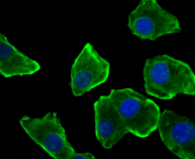 Nesprin 1 Rabbit mAb