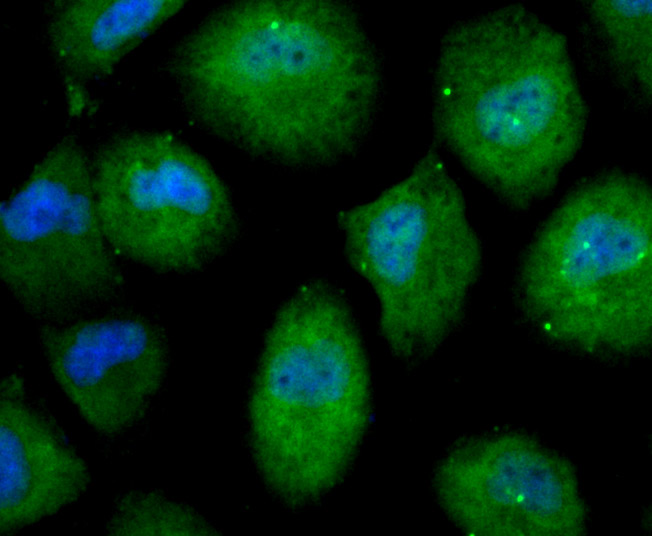 Nesprin 1 Rabbit mAb