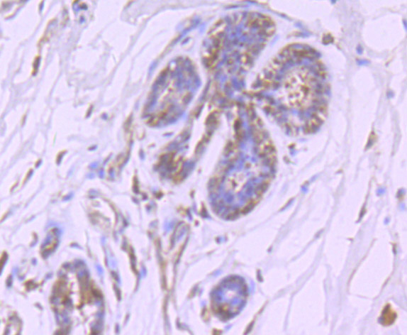 HIF-2 alpha Rabbit mAb