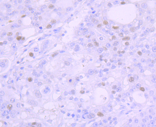 p53 Rabbit mAb