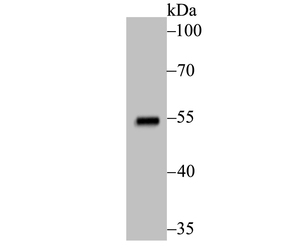 p53 Rabbit mAb