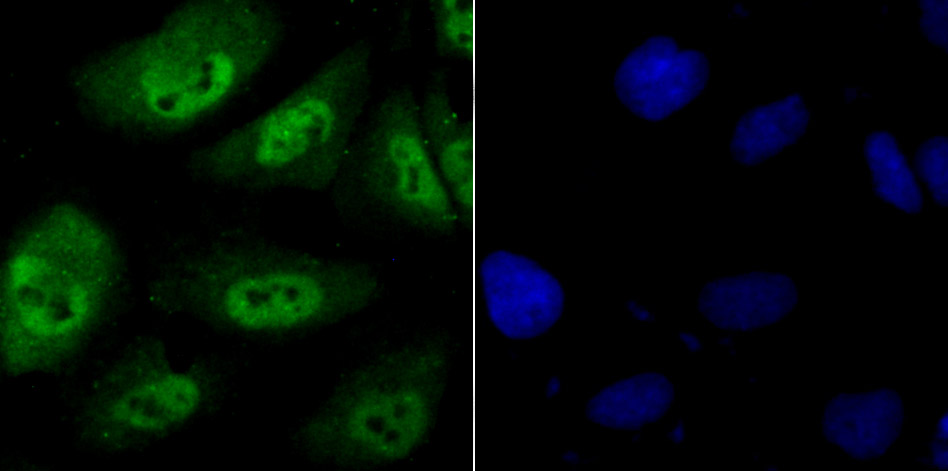 Proteasome 20S LMP7 Rabbit mAb