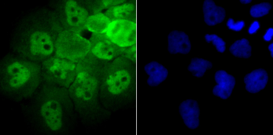 Proteasome 20S LMP7 Rabbit mAb