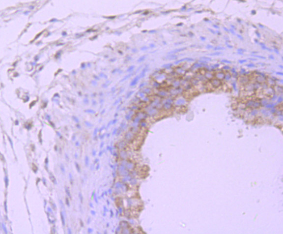 Proteasome 20S LMP7 Rabbit mAb