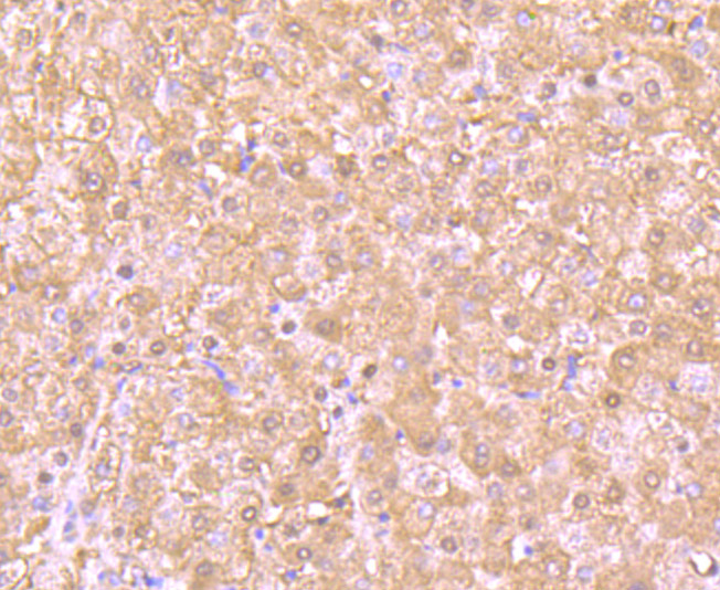 Proteasome 20S LMP7 Rabbit mAb