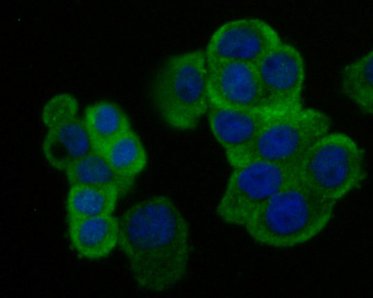 Creatine kinase B type Rabbit mAb