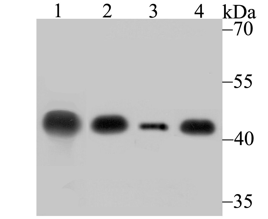 Creatine kinase B type Rabbit mAb