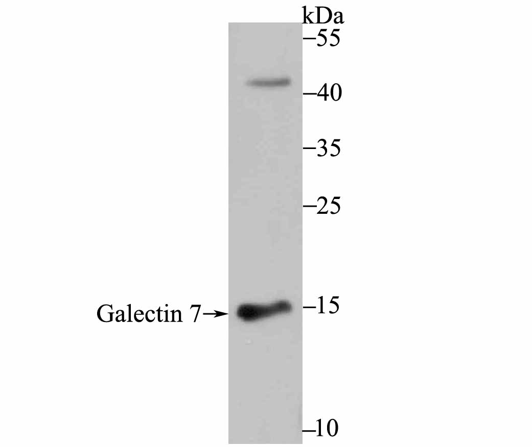 Galectin 7 Rabbit mAb
