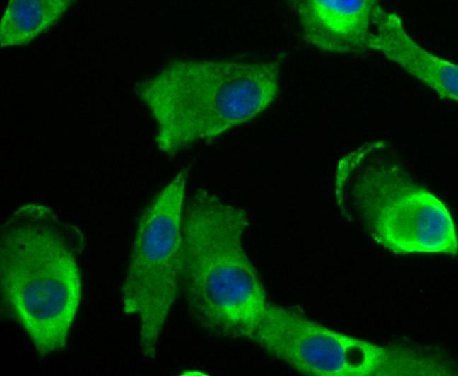 Niemann Pick C1 Rabbit mAb