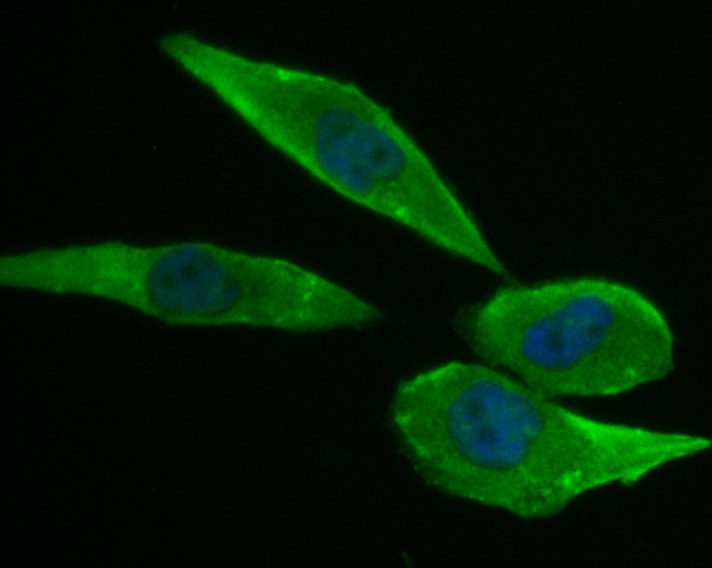 Niemann Pick C1 Rabbit mAb