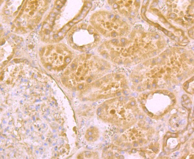 Niemann Pick C1 Rabbit mAb