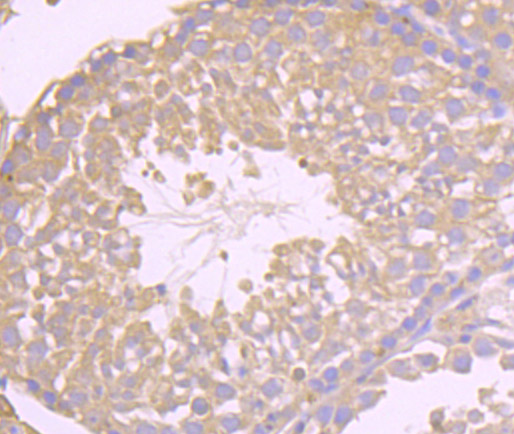 Niemann Pick C1 Rabbit mAb