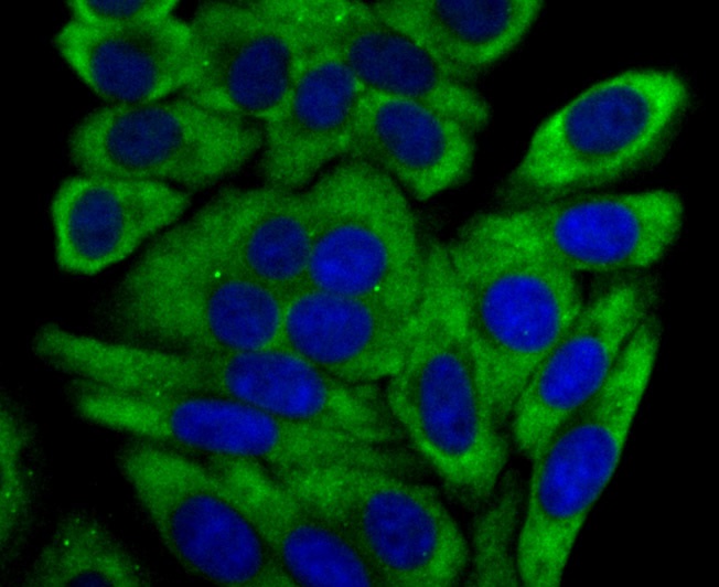 Cytochrome P450 17A1 Rabbit mAb