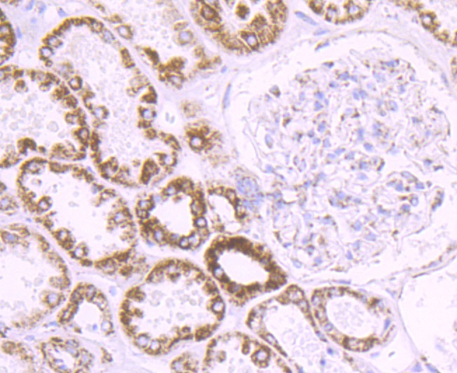 Cytochrome P450 17A1 Rabbit mAb