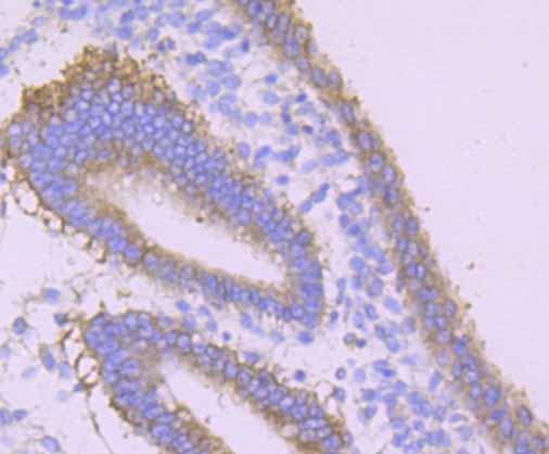 DSG1 Rabbit mAb
