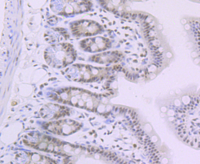SNF5 Rabbit mAb
