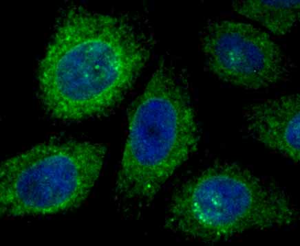KDEL Rabbit mAb