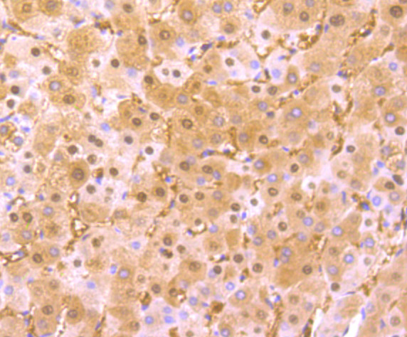 Liver Arginase Rabbit mAb