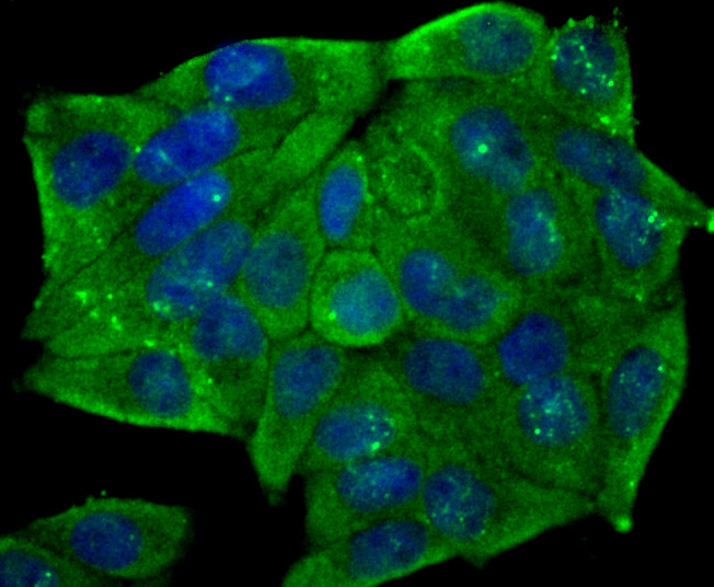 CD146 Rabbit mAb